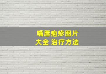 嘴唇疱疹图片大全 治疗方法